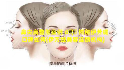 鼻尖高整形案例 🦟 揭秘伊芳缇口碑如何(伊芳缇美容连锁机构)